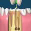 images/Endodonzia/Img02.jpg