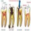 images/Endodonzia/Img03.jpg