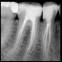 images/Endodonzia/Img04.jpg